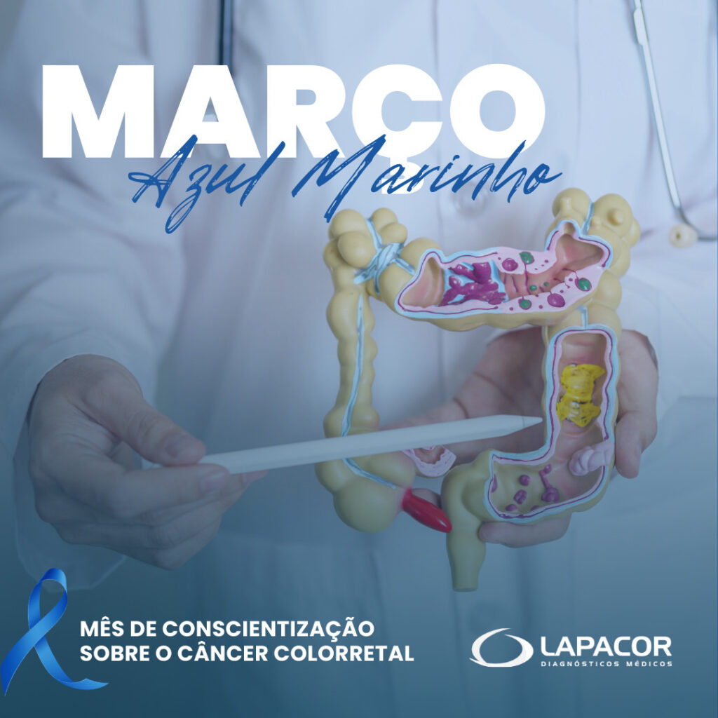 Março Azul Marinho: conscientização sobre o Câncer Colorretal
